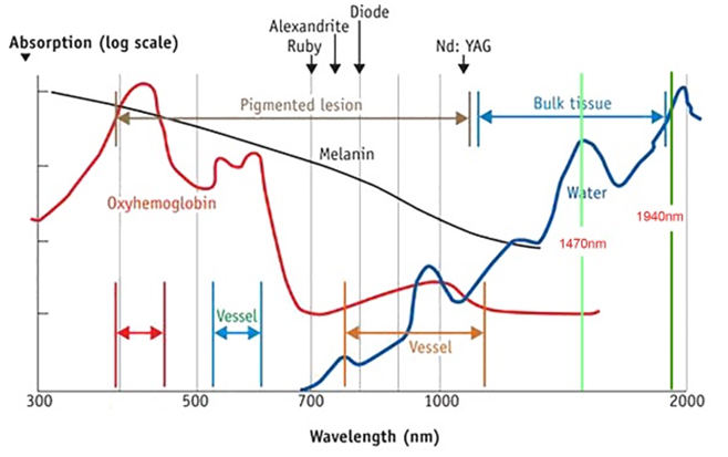 difference between 1470nm and 1940nm endovenous laser